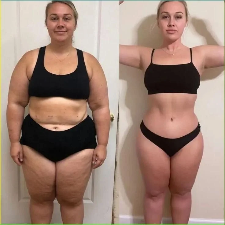Before and after